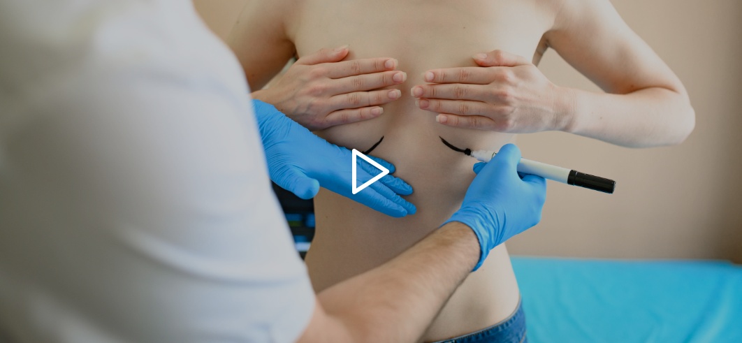 supuesto video