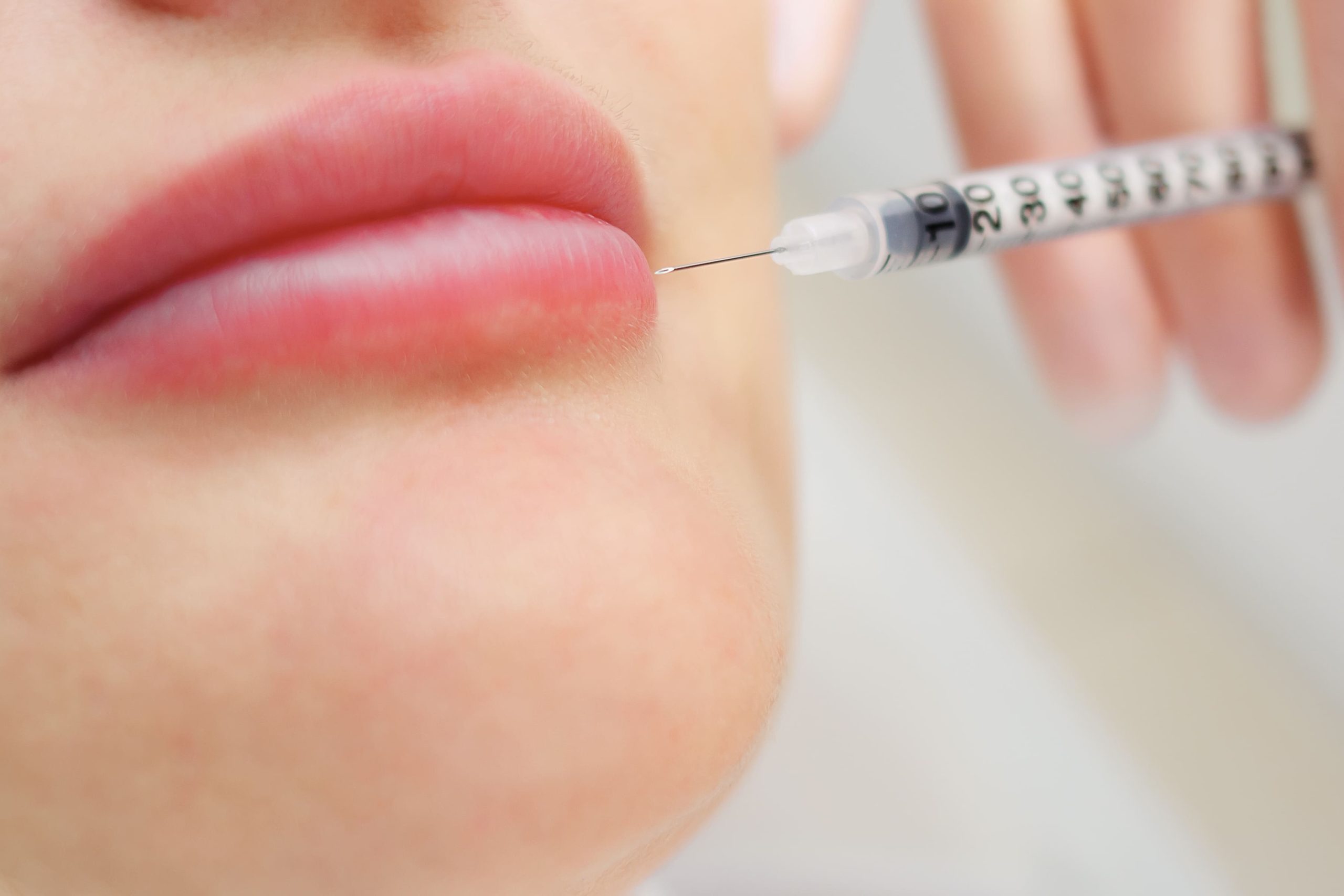 aumento de labios valencia