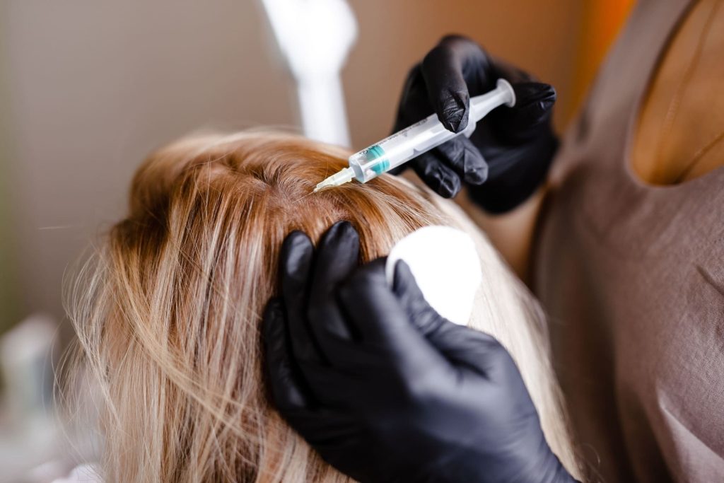 especialista realizando tratamiento de plasma capilar prp